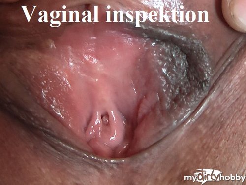 mailinh69 - Vaginal inspektion