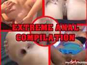 aische-pervers – BEST OF EXTREME ANAL
